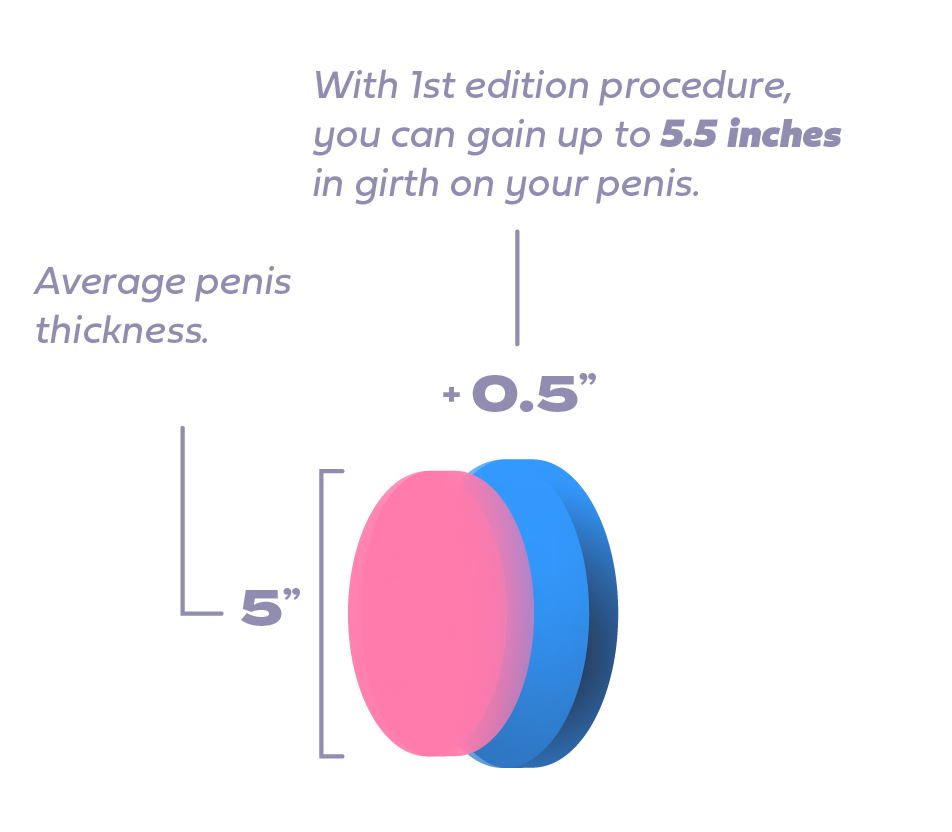 Medidas Relleno 1st Edition_Ingles