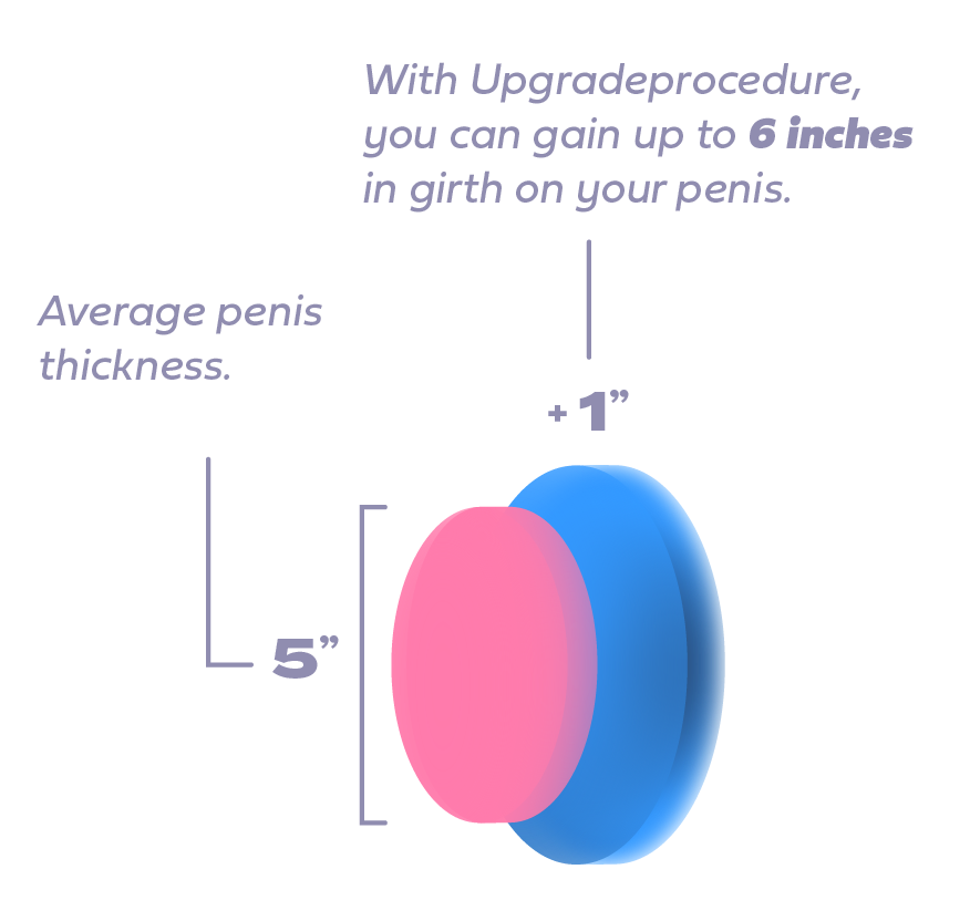Medidas Relleno Upgrade _Ingles