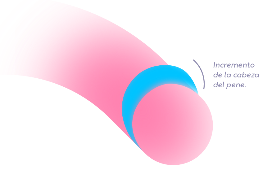 Medidas Relleno Upgrade Glande